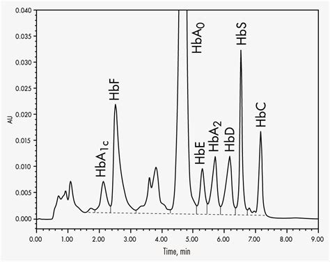 hemoglobin variants hplc