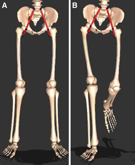 Three Dimensional Modeled Psoas Lengths Were Obtained Using Gait