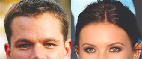 Female Hairline Vs Male Hairline 4 Main Differences 2pass Clinic