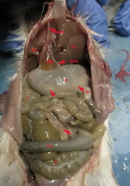 Showing The Insitu View Of Gall Bladder Gb With Cystic Duct And Gall