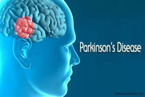 Parkinson Gene Nerve Growth Factor Halts Mitochondrial Degeneration
