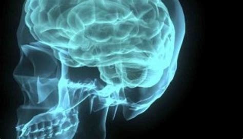 epilepsie door vroegere hersenschade gezondheidsnet
