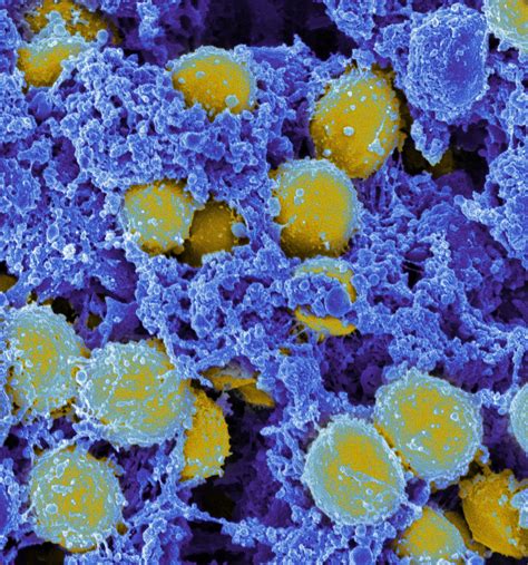 filestaphylococcus aureus bacteria jpg