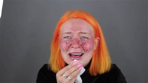 This Youtuber S Henna Semi Permanent Freckle Fail Is The Biggest