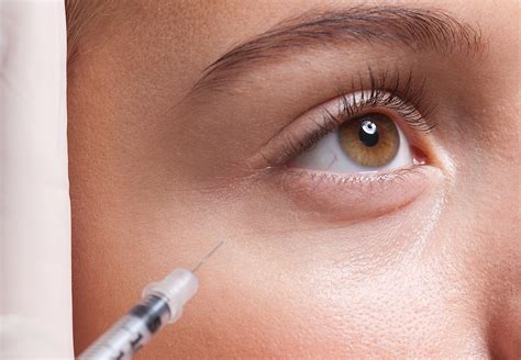 tear trough fillers  eye rejuvenation  illume med spa