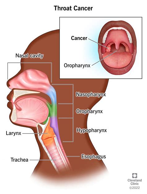 top    check  throat cancer  home