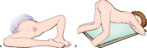 vaginal exam frog leg position bobs and vagene