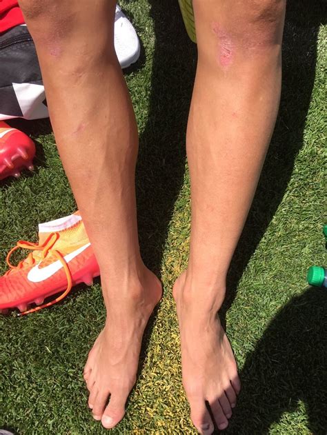 tobin heath s feet