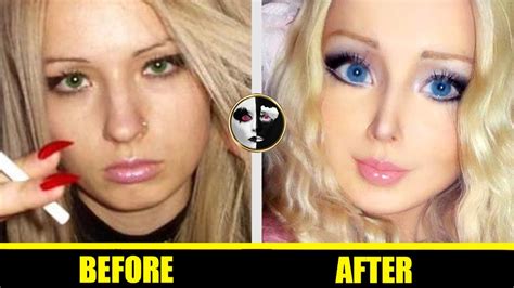 Valeria Lukyanova 👧 Barbie Doll Plastic Surgery Before And After 👧