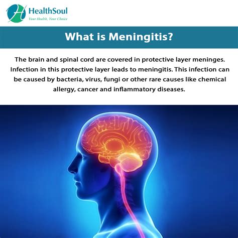 Meningitis Causes Symptoms And Treatment Healthsoul