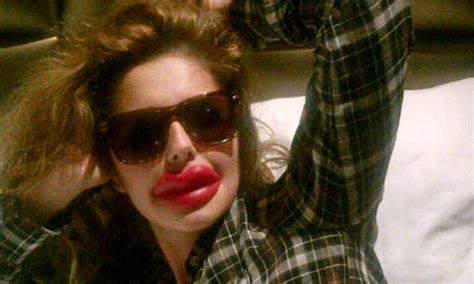 Cheryl Cole Shows Off Huge Lips In La Poking Fun At Plastic Surgery