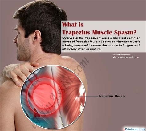 mind numbing facts  muscle spasm  outer ear muscle spasm  outer ear  expert
