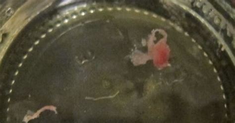 please help me identify possible nasal worm w pics at parasites support forum alt med with