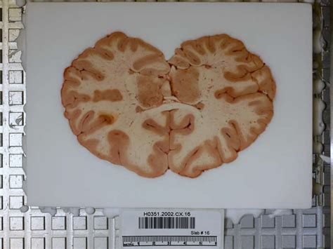 decoding patterns    brains human neuroscience news