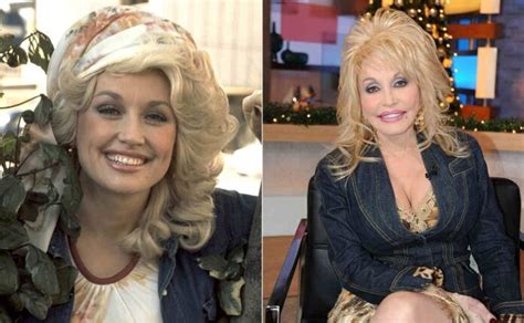 dolly parton plastic surgery with before and after photos