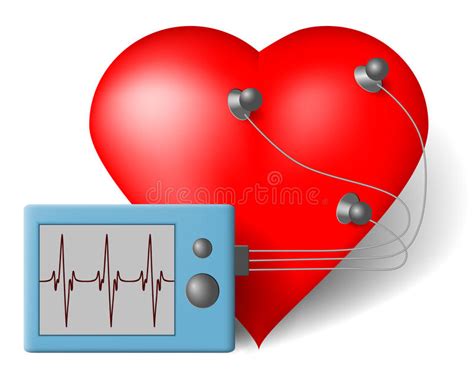 holter heart monitor lead placement chart stock vector illustration