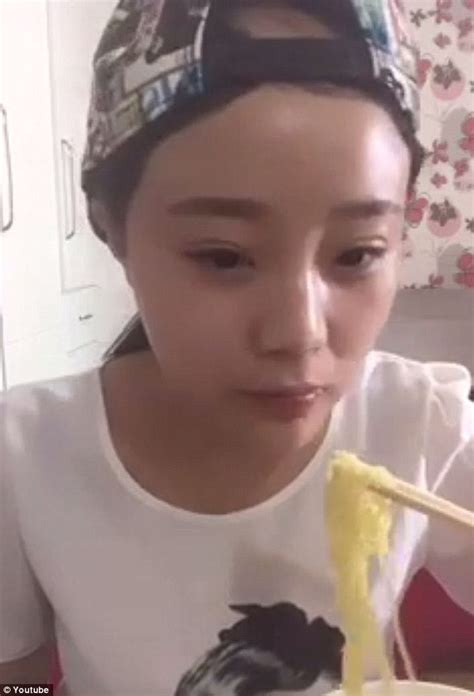 chinese woman eating corn with a drill releases video of herself receiving treatment daily