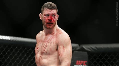 The Most Horrific Post Fight Faces Ever Creepy Gallery