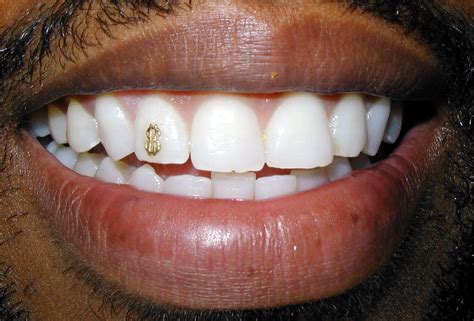 teeth jewels    teeth grills