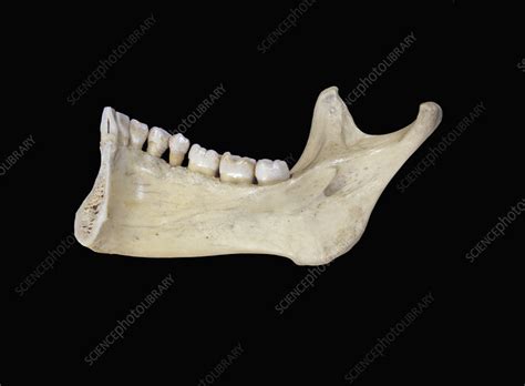 human  jaw bone stock image  science photo library