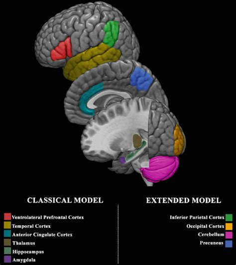 bipolar brain