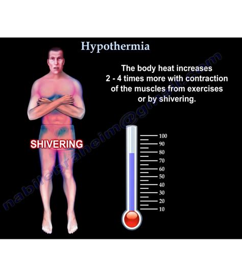 hypothermia principles  management orthopaedicprinciplescom