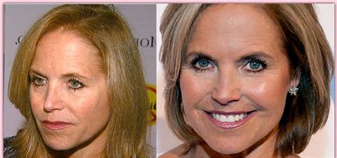 katie couric plastic surgery before and after photos