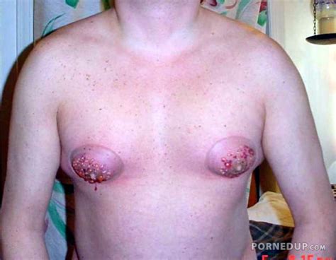 guy has fucked up nipples porned up