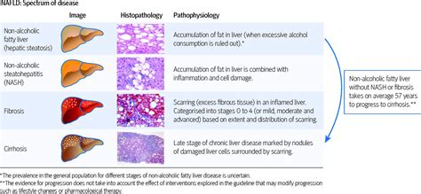 researchers    discovery   disease pathogenesis   liver  regulated