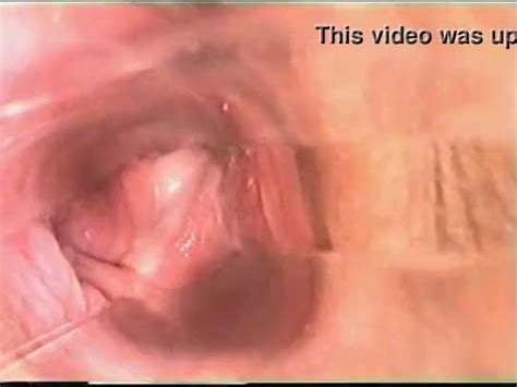 speculum camera inside vagina xxx sexe bizarre porn tube