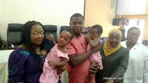 How Nigerian Hospital Separated Conjoined Twins Premium