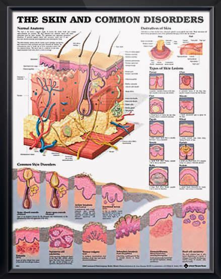 skin  common disorders anatomy poster vividly depicts cross