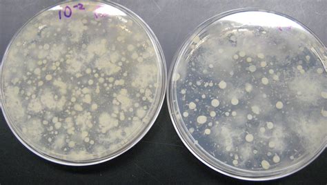dvc microbiology  fall  gard lab  standard plate count  soil bacteria