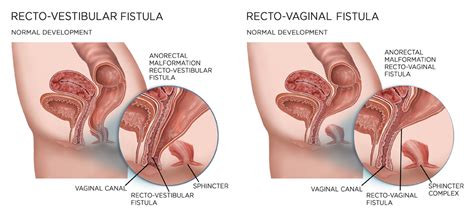 vaginal discharge in panties mega porn pics