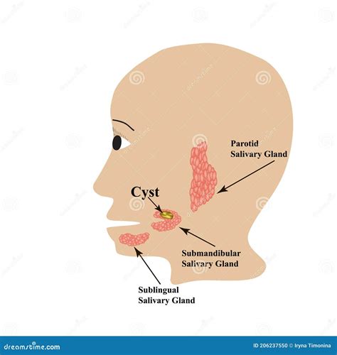 tumor   parotid salivary gland cartoon vector cartoondealer