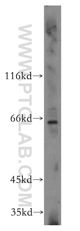 cyclonccdc antibody   ap proteintech