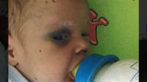 bebê menino fica em estado crítico após levar um soco de sua mãe
