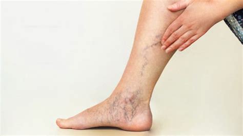 common leg pain symptoms page   health