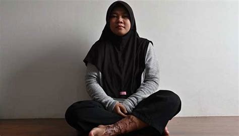 Indonesian Maid S Torture Highlights Lack Of Legal Protections Lahore
