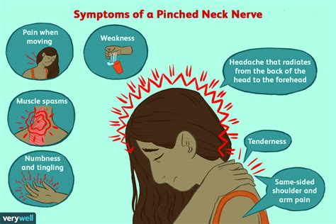 pinched nerve symptoms   neck