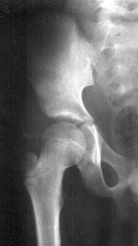 x ray sex from behind