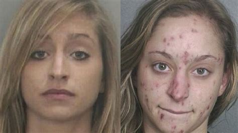 20 before and after drug use photos youtube