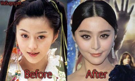 Fan Bingbing Plastic Surgery Before And After Boob Job Pictures