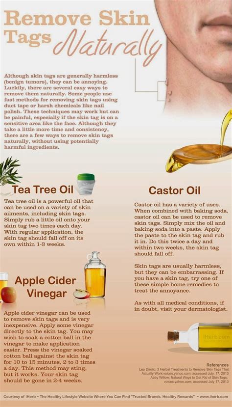 how to remove skin tags naturally [infographic] using tea tree oil castor oil or apple cider