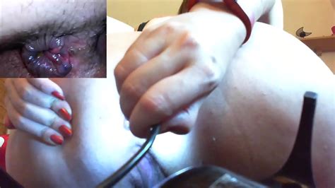 Hardcore Anal Session With A Medical Endoscope A Super Medical Fetish