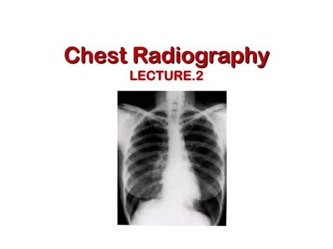 Ppt Chest Radiography Lecture Powerpoint Presentation Free Hot Sex