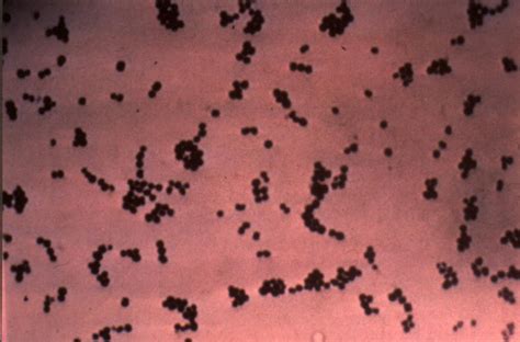 Bsci 424 Staphylococcus Images