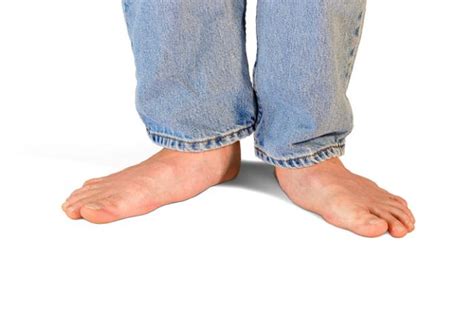 what are flat feet and what can we do about them