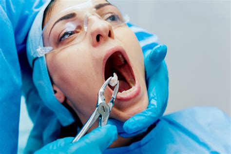 tooth extraction  process  tooth removal  dentist  toronto
