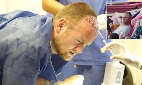 Wayne Rooney Grimaces In Pain During His Hair Transplant Procedure